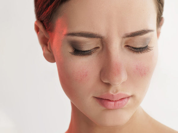 5 causes of red face and how to reduce 