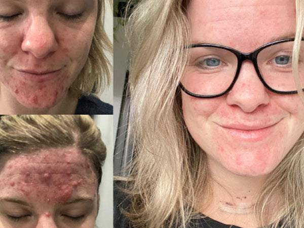 Real Results: Erica's Story