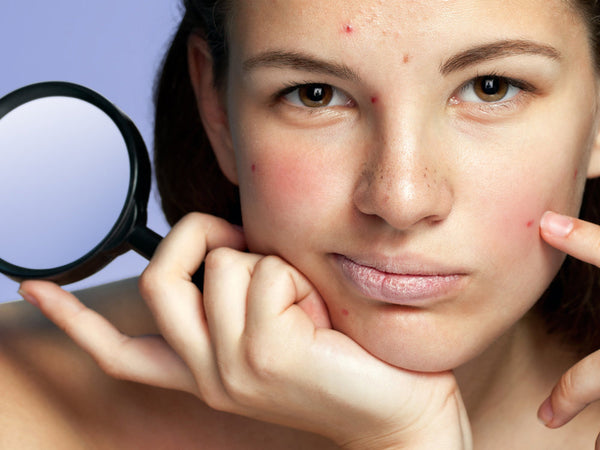 Signs Your Skin Care Routine is Damaging Your Skin – esmi Skin