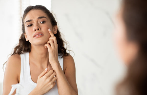 Blemishes & How To Get Rid of Them
